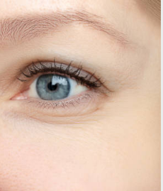 After Botox Treatment